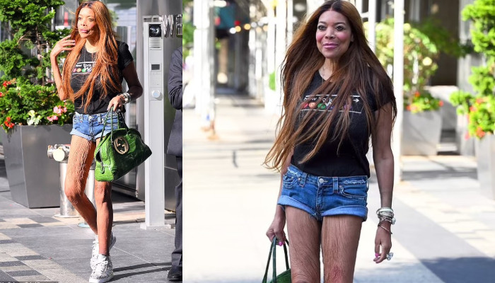 Wendy Williams Shocks Fans With Wrinkly Legs